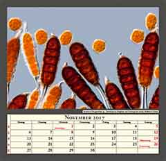 Rose rust Phragmidium sp., Teleutospores (long) and Uredospores (round)