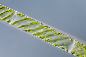 Spirogyra sp.