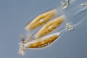 Diatoms Cymbella