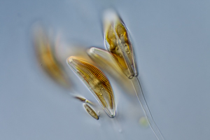 Diatomeen Cymbella