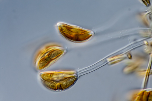 Diatoms Cymbella