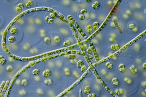 Klebsormidium(?) und Pseudosphaerocystis