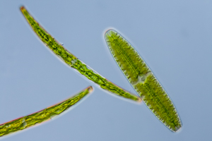 Closterium sp. and Netrium digitus