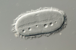 Anoplophrya sp., Makronukleus und kontraktile Vakuolen