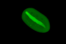 Anoplophrya sp., Acridinorange Fluorescence