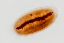 Anoplophrya sp., Protargol-Imprägnation