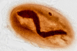 Anoplophrya sp., Protargol-Impregnation