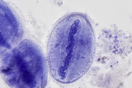 Anoplophrya sp., staining with Hämalaun