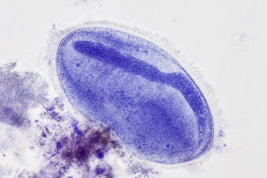 Anoplophrya sp., staining with Hämalaun