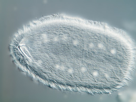 Metaradiophrya sp., Hakenapparat und kontraktile Vakuolen