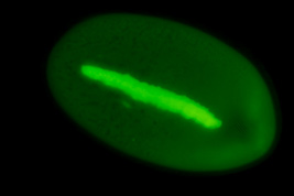 Metaradiophrya sp., Acridinorange, Fluoreszenz