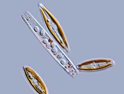 Navicula und Diatomeenschale mit Algenparasiten