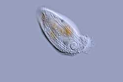 Pseudochilodonopsis sp. Ciliate