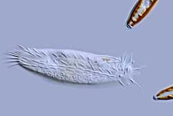 Holosticha Ciliate