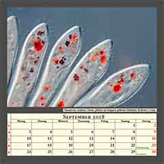 Paramecium caudatum Ciliaten, gefüttert mit Kongorot-gefärbten Hefezellen, Bildbreite 0,25mm