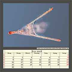 Pluteus-Larve von Echinocardium cordatum, Herz-Seeigel, Bildbreite 1mm