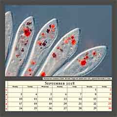 Paramecium caudatum ciliates, fed with Congo-red stained yeast cells, captured field width 0,25mm