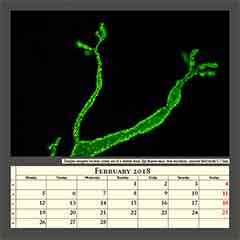 Zooglea ramigera bacteria colony out of a shower drain, Epi-florescence, blue excitation, captured field width 0,17mm