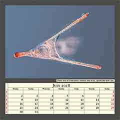 Pluteus larva of Echinocardium cordatum, heart urchin, captured field width 1mm