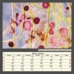 Rhodobacteria, Cyanobacteria and Spirogyra sp. filaments, image width 0,26mm