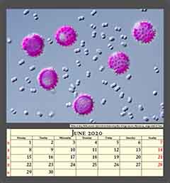 Pollen of daisy, Bellis perennis (dyed with fuchsine) and pollen of forget-me-not, Myosotis sp., image width 0,17mm