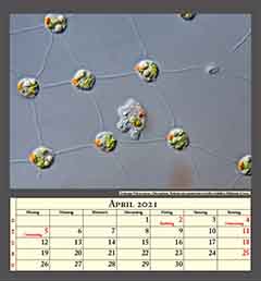 Grünalge Volvox aureus, Chlorophyta,  Kolonie mit parasitischen Amöben befallen, Bildbreite 0,1mm