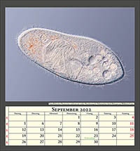 Pantoffeltierchen Paramecium caudatum mit starker Parasitierung des Makronucleus durch Holospora sp., Bildbreite 0,2mm