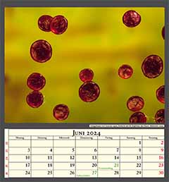 Stängelhaare von Sonchus asper, Aufsicht auf die Köpfchen der Haare. Bildbreite 1mm