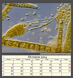 Brown alga Ectocarpus sp., spore release from the sporangium. Image width 0.2mm