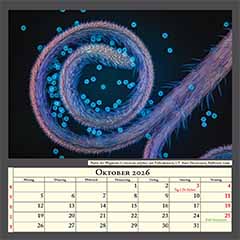 Narbe der Wegwarte (Cichorium intybus) mit Pollenkörnern, UV Auto-Fluoreszenz, Bildbreite 1mmm