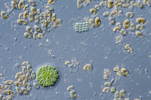 Coleochaete green alga and diatoms Cocconeis