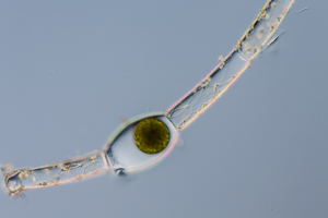 resting cyst of spirogyra