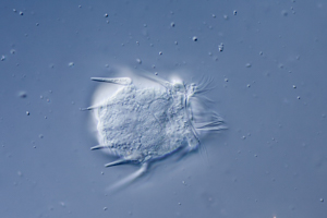 Hastatella radians Ciliate