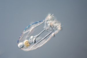 Asplanchna rotifer