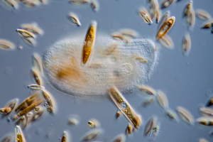 Chilodonella Ciliat mit Diatomeen