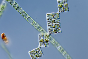 diatom Tabellaria